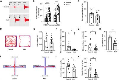 Contribution of Amygdala Histone Acetylation in Early Life Stress-Induced Visceral Hypersensitivity and Emotional Comorbidity